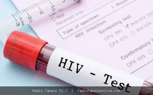 Security recruitment: 1,300 reactive HIV tests not confirmed diagnoses — AIDS Commission