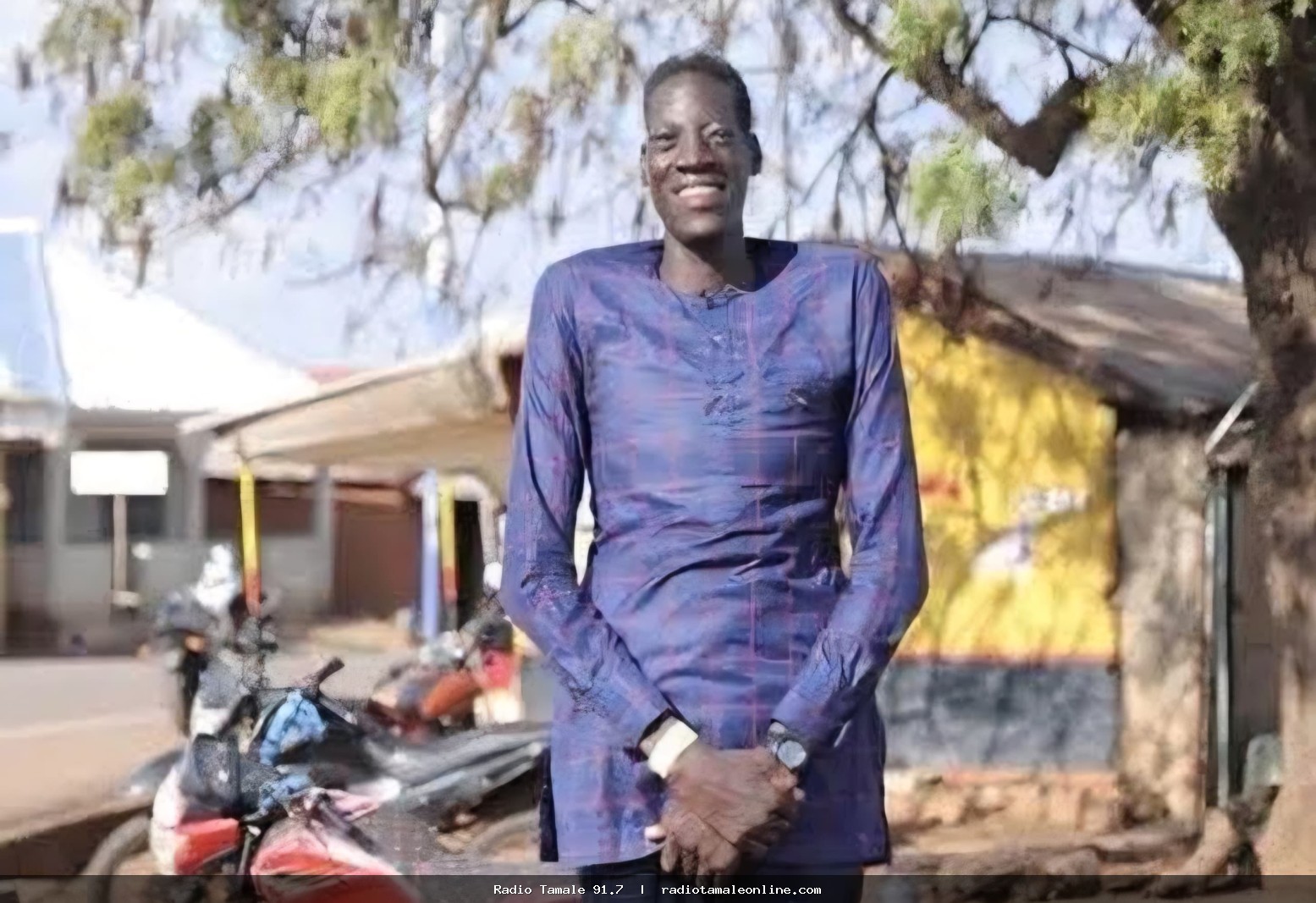 Awuche’s Leg Will Not Be Amputated After Fresh Medical Assessment At Tamale Teaching Hospital