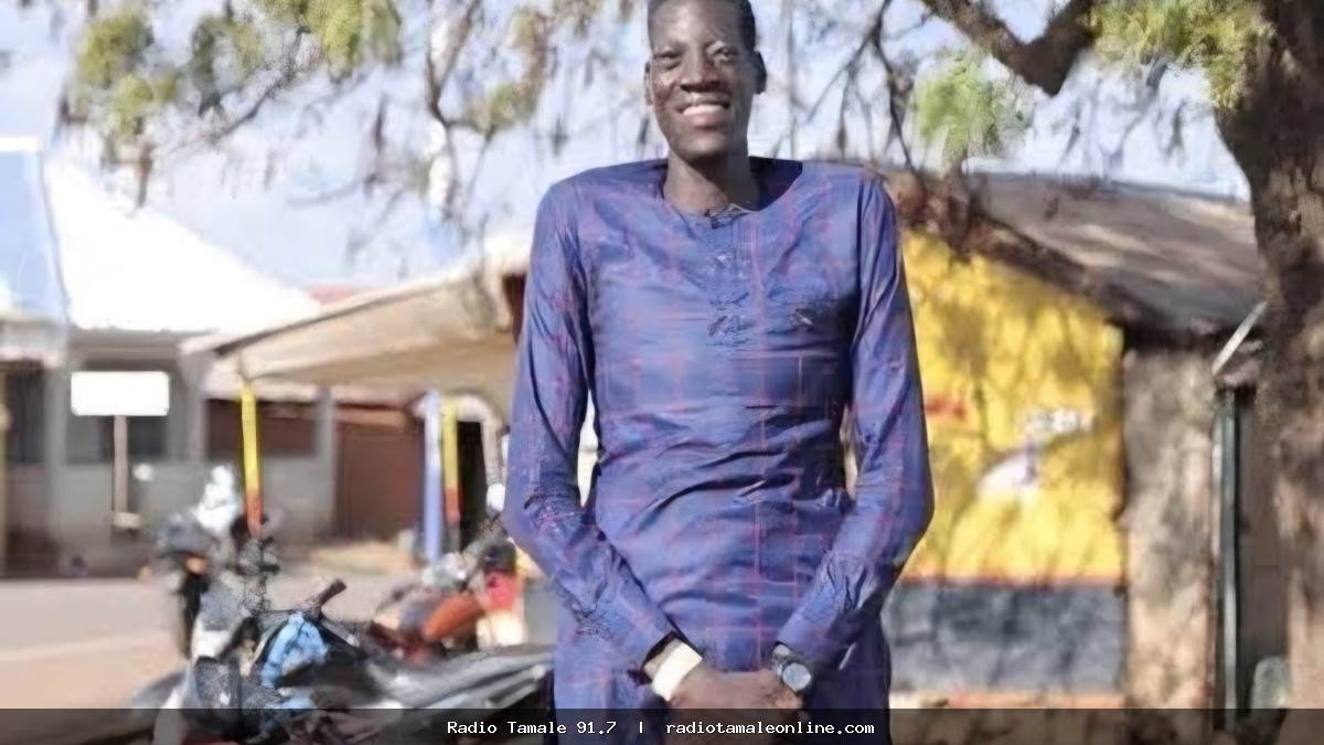Awuche’s Leg Will Not Be Amputated After Fresh Medical Assessment At Tamale Teaching Hospital